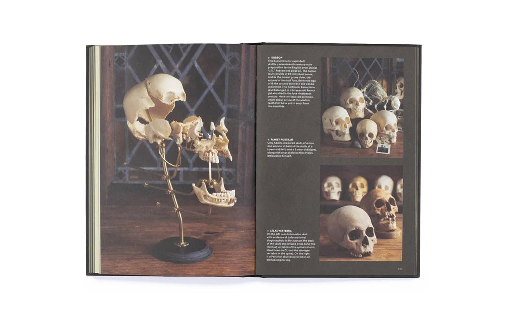 Skulls
