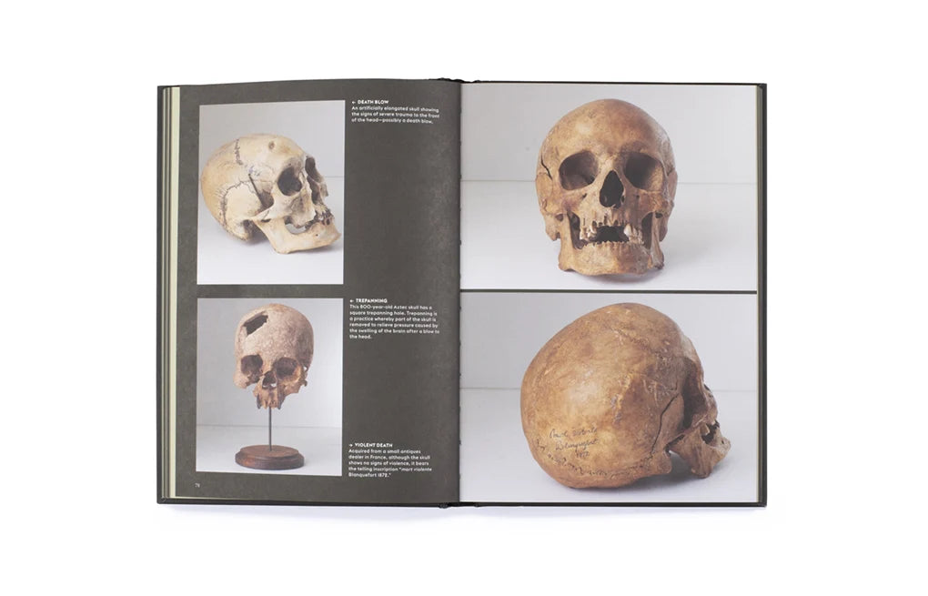 Skulls