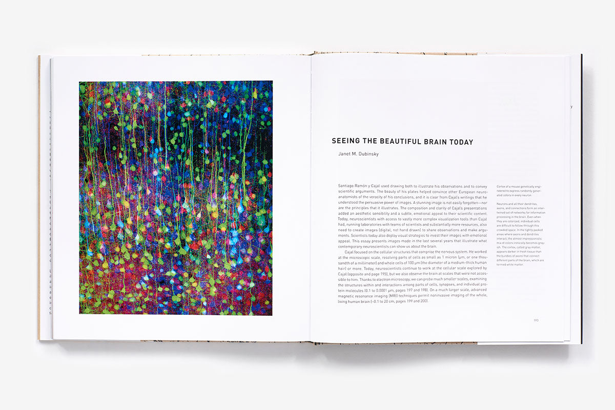 The beautiful brain